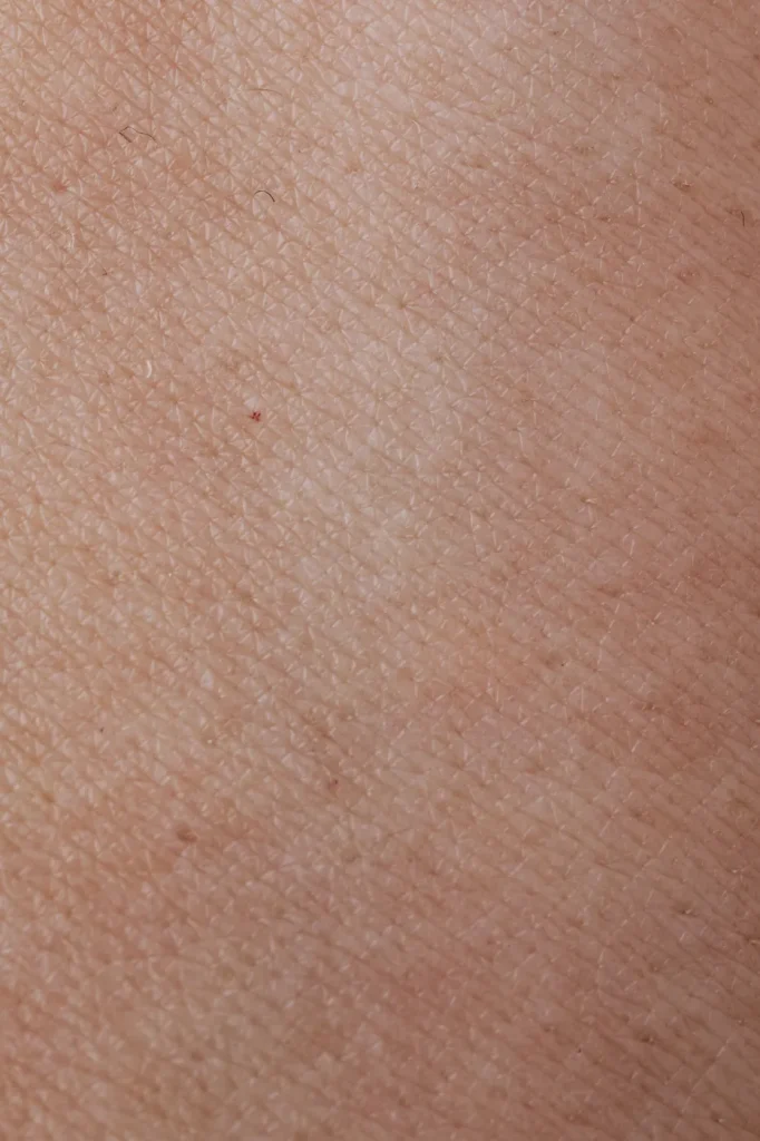 Peau claire neutre